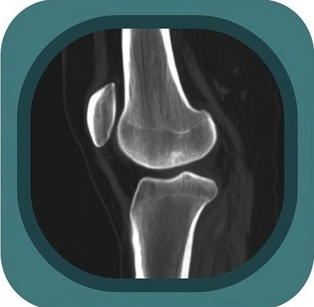 CT knee anatomy icon